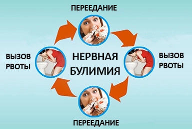 Лечение булимии в Старощербиновской